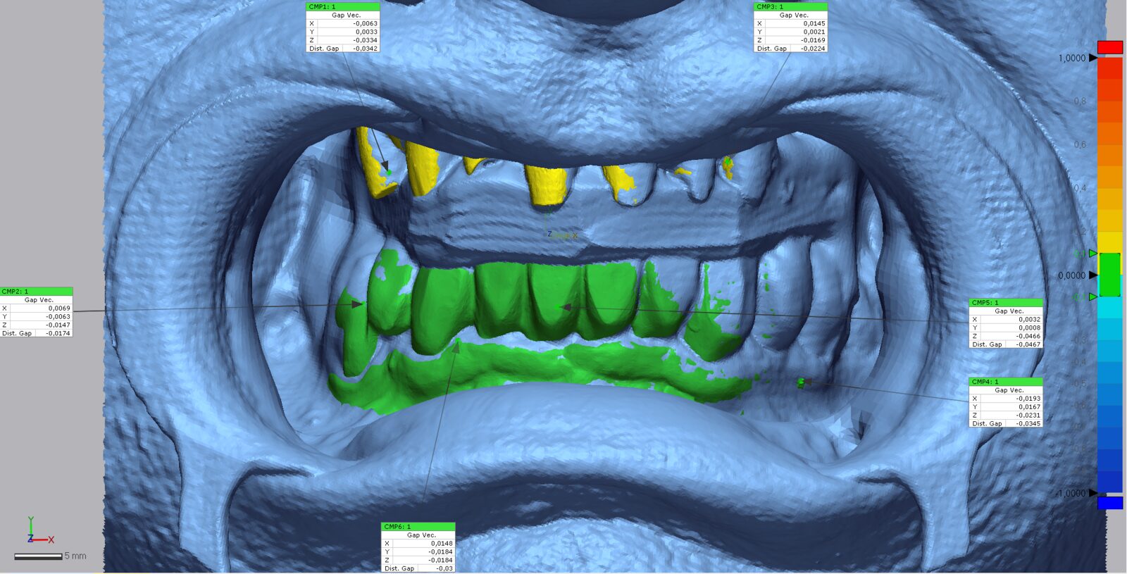 Analisi digitale dei contatti occlusali