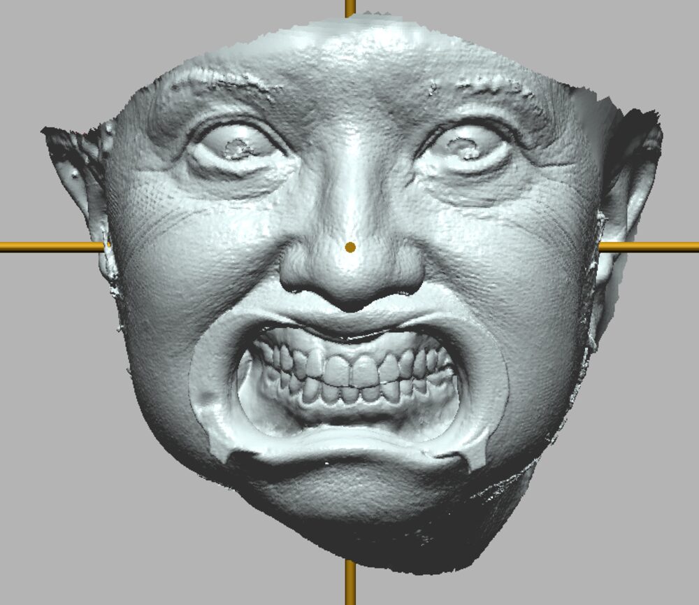 Scansione 3D del volto del paziente per l'analisi funzionale