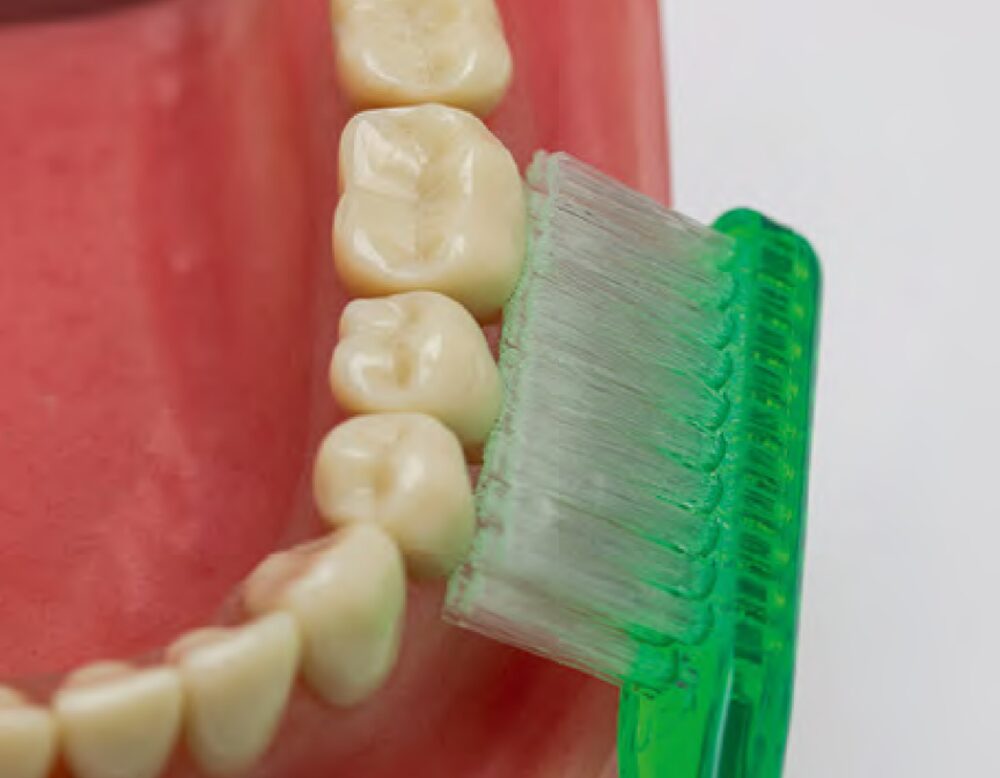 Tecnica di spazzolamento corretta mostrata su modello